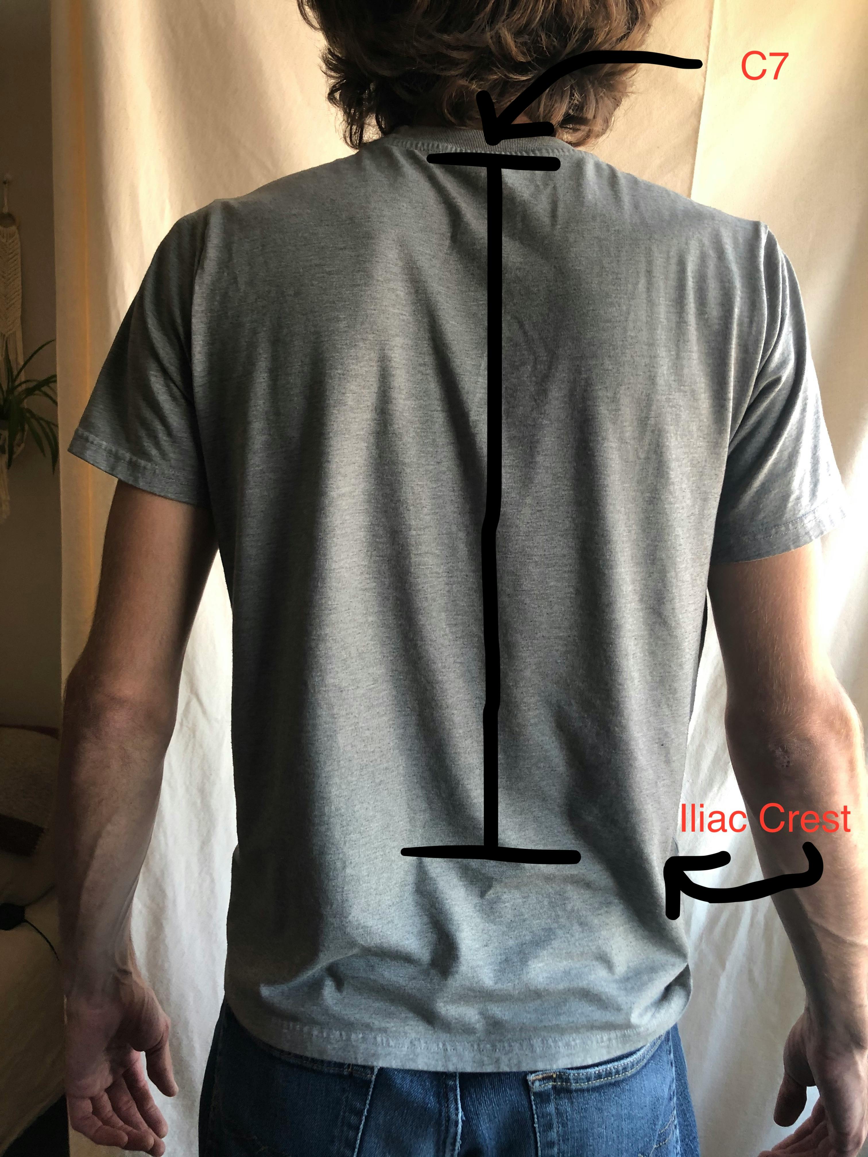 A photo of a man's back with diagrams showing the C7 and iliac crest